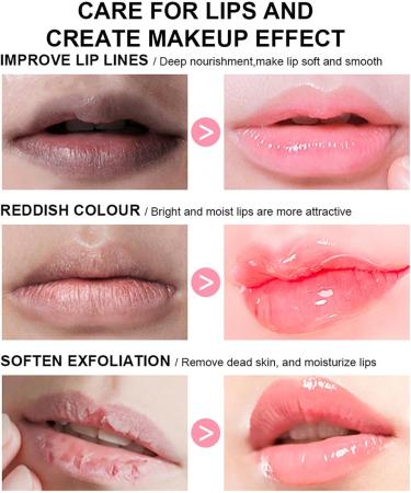 Rosarden Lip Balm for Dry - Chapped & Cracked Lips - Ultra Conditioning Lip Repair - Peach Flavoured Long Lasting Lips Moisturizer Intensive Lip Balm - 24h Moisture Care - Buy Online on GoSupps.com