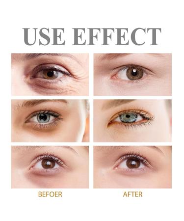Eye Firming Gel Lightens Fine Lines Eye Bags Hydrating Firming Eye Skin Eye Cream - Buy Online on GoSupps.com