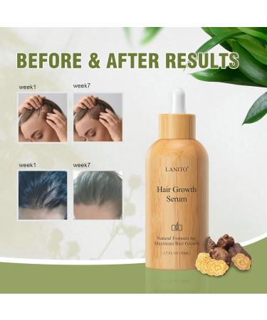 Hair Growth Serum with Radix Polygonum Multiflorum - Fight Hair Thinning & Fall | 50ml | Strengthen & Thicken Hair for Men & Women - Buy Online on GoSupps.com