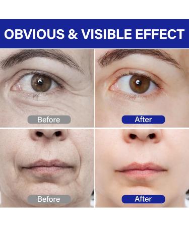 PDRN Serum Lifts and firms Reduces Wrinkles Deeply Moisturizes Peptides PDRN Anti-aging Improves Dullness Blue - Buy Online on GoSupps.com