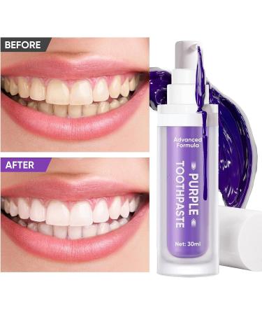 Purple Toothpaste for Teeth Whitening  Teeth Whitener  Whitening Toothpaste for Tooth Stain Removal  Fights Bad Breath 30 - Buy Online on GoSupps.com