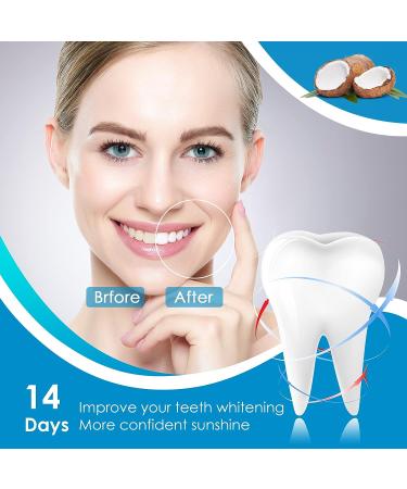 Coconut Teeth Whitening Strips 14PC - Sensitive Non-Toxic Formula | Safe for Enamel - Professional Hydrogen Peroxide Whitener for Coffee, Wine, Tobacco Stains - Buy Online on GoSupps.com