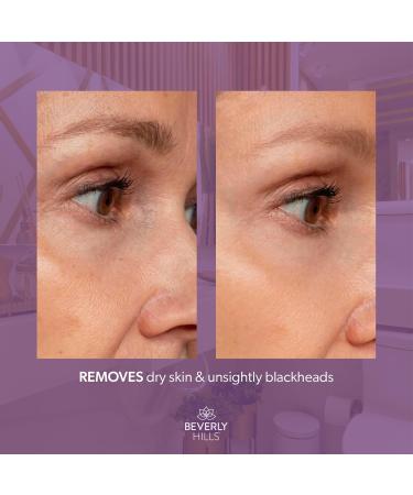 Beverly Hills BHA Gel 2% Salicylic Acid | Best Facial Exfoliator & Acne Treatment | Hydrating BHA Exfoliant for Blackheads & Pore Cleaning - 30mL (60 Days Supply - Buy Online on GoSupps.com