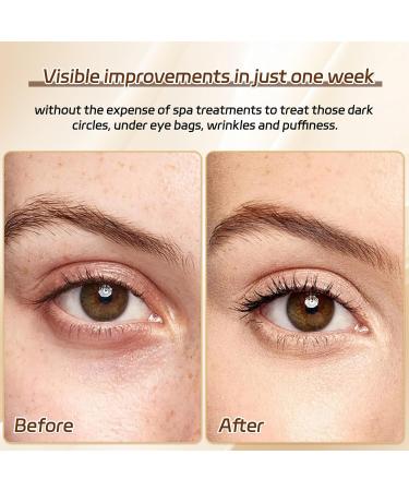 50 Pairs 24k Gold Under Eye Patches - Collagen Eye Masks for Dark Circles & Puffiness | Reduce Wrinkles & Revitalize Skin - Buy Online on GoSupps.com