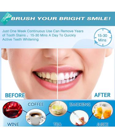 Enamel-Safe 5D Teeth Whitening Kit for Sensitive Teeth - 30-Minute Express Whitening - Non-Toxic Formula - 14 Pcs (7 Treatments) - Buy Online on GoSupps.com