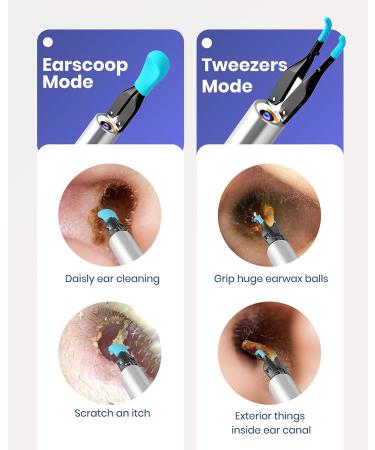 BEBIRD Ear Wax Removal Kit with HD Otoscope & LED Light - 3 in 1 Earwax Remover for Adults & Kids (Blue) - Buy Online on GoSupps.com