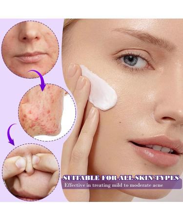  Kaslaider Moisturizing night cream for the face 12% azelaic acid for the face skin care cream with niacinamide and vitamin C anti-acne facial serum for most redness and - Buy Online on GoSupps.com