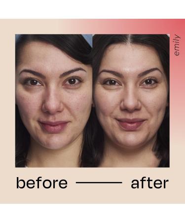 Retinol Serum for Face & Neck 2.5% - Face Serum w/Hyaluronic Acid Aloe Vera & Vitamin B3 Resurfacing Retinol Serum Moisturizing & Brightening Retinoid Serum for Women & Men - Buy Online on GoSupps.com