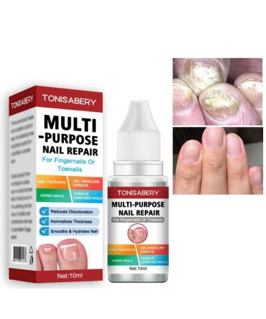 Fungal Nail Treatment Nail Fungus Treatment For Toenail Toe Nail Fungal Treatment Ingrown Toenail Treatment Toenail Fungus Treatment For Toenails Extra Strong Strengthen Renew Damaged Nail