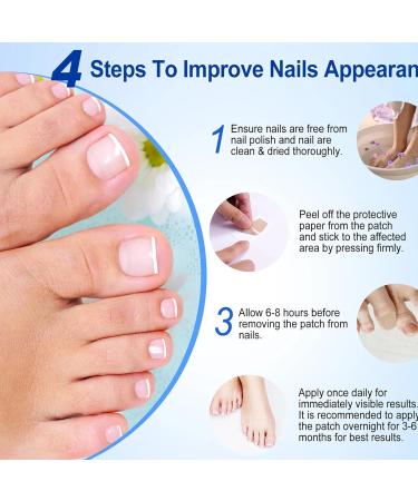 Fungal Nail Treatment - Nail Fungus Treatment for Toenail - Toe Nail Treatment Extra Strong - Nail Repair Treatment for Restores Damaged Nails - 8 Hours Nail Repair Restores Healthy Nails(32 Patches) - Buy Online on GoSupps.com