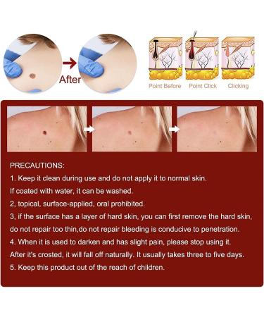 WZDYN 2023 New Wipe Off and Remover | Extreme Skin Wipe Off & Remover | Fast Easy to Remove | for Face Armpit Flesh Neck (5pcs) - Buy Online on GoSupps.com