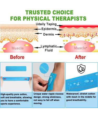 ATETEO Kinesiology Tape XL - Light Green - 5m x 7.5cm | Premium Quality - Buy Online on GoSupps.com