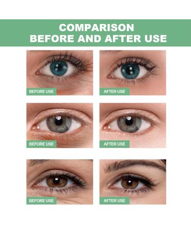 60 PCS Aloe Vera Eye Masks - Gel Collagen Under Eye Patches for Puffy Eyes Dark Circles & Anti-Aging Treatment - Buy Online on GoSupps.com