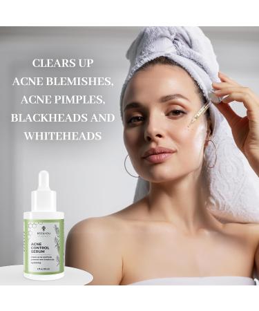 BEE and YOU Acne Treatment with Salicylic Acid Bee Venom and 100% Natural Propolis Extract Acne Serum for Face and Body to Control and Clear Breakouts |1 Ounce - Buy Online on GoSupps.com