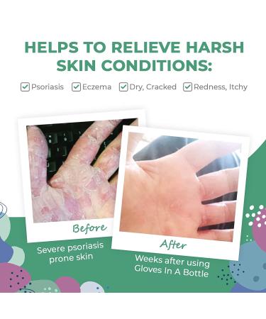 Shielding Lotion for Dry Skin - Gloves In A Bottle Hand Lotion Travel Size - Protects & Restores Dry Cracked Skin (3.4 Fl Oz, Botanical) - Buy Online on GoSupps.com