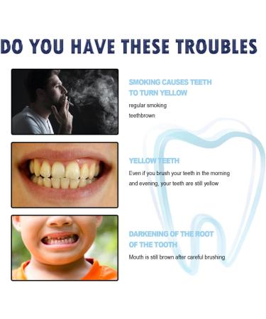 Teeth Whitening Pen - Pain-Free Tooth Bleaching Travel Size (5pc) | Quick & Gentle Tooth Whitening - Buy Online on GoSupps.com