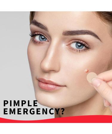 Original Hydrocolloid Acne Pimple Patch - Invisible Spot Stickers for Face & Skin Perfect for Teens - Blemish Coverage & International Shipping - Buy Online on GoSupps.com
