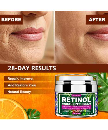 Buy Retinol Cream for Wrinkles & Fine Lines - 1.7 oz Moisturizer for All Skin Types - International Shipping Available - Buy Online on GoSupps.com