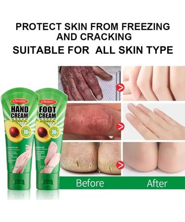 Foot Cream urea Foot Cream Avocado Foot Cream For Very Dry Feet Hydrating Hard Skin Remover Foot Cream Athletes Foot Cream Extra Strong Athlete Foot Cream Nourishing Dry Foot& Foot Skincare-Feet Cream - Buy Online on GoSupps.com