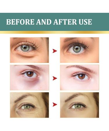  Orgrul Jasmine ointment dark circles under the eyes jasmine cream cream for under-eye bags active jasmine ointment eye cream for wrinkles and dark circles eye cream with - Buy Online on GoSupps.com