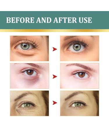 Jasmine Ointment Eye Cream with Collagen & Aloe Vera - Dark Circles Wrinkles & Puffiness Relief (2PC) - International Shipping Available - Buy Online on GoSupps.com