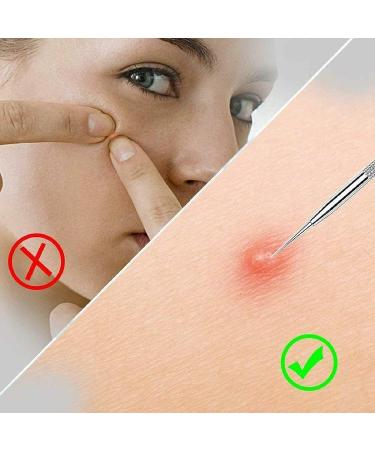 Blackhead Remover Pimple Extractor Tool Acne Kit - Blemish Treatment for Nose & Face Skin - Buy Online on GoSupps.com