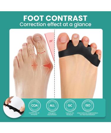 Welnove Toe Separators Bunion Corrector - 8 Pcs Gel Straighteners for Hammertoes | Buy Now for Pain Relief & Correct Foot Alignment - Buy Online on GoSupps.com