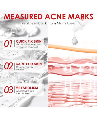 Gel Localis Anti-Imperfections Peaux Mixtes Grasses Action Anti-Imperfections Formule Douce Texture L g re - Buy Online on GoSupps.com