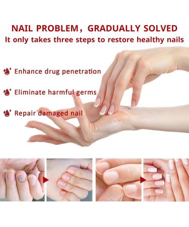 TBeautfave Fungal Nail Treatment Antifungal Nail Treatment Toe Nail Fungal Treatment Fungal Nail Treatment for Toenails Extra Strong Nail Repair and Strengthen Fix & Renew Damaged Broken Nails - Buy Online on GoSupps.com