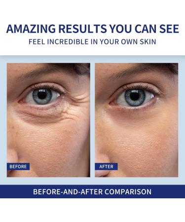 Allony Serum Anti Wrinkle Essence 30ml Anti Wrinkle Essence Active Eye Cream for Dark Circles and Puffy Eyes Reduce Fine Lines Hydrate & Firm - Buy Online on GoSupps.com