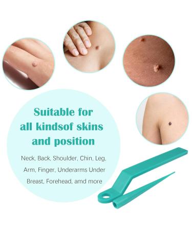 Skin Day Distant Micro Skin Tag Removal Kit - Efficiently Remove Small Skin Tags (4mm & Below) with 20 Ribbons & 72 Patches - Buy Online on GoSupps.com