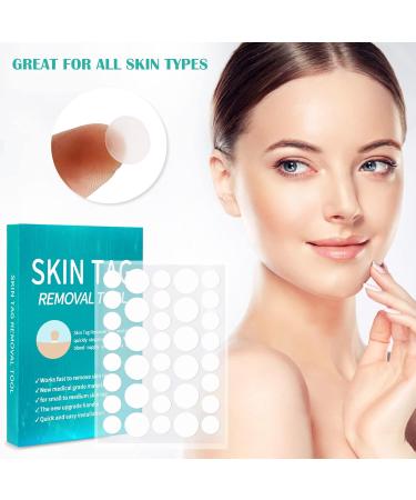 Skin Day Distant Micro Skin Tag Removal Kit - Efficiently Remove Small Skin Tags (4mm & Below) with 20 Ribbons & 72 Patches - Buy Online on GoSupps.com