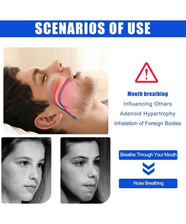 Adjustable Anti-Snoring Chin Strap for Deep Sleep | Breathable & Comfortable | Stop Snoring Solution for Men, Women & Kids - Buy Online on GoSupps.com