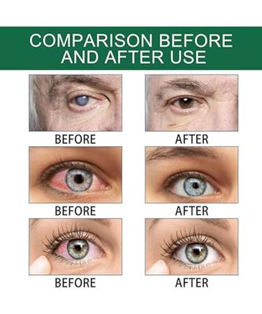 Solution de soin hydratante pour les yeux gouttes oculaires anti- ge soulage la fatigue oculaire am liore la vision 1PCS - Buy Online on GoSupps.com