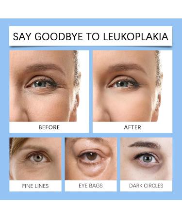 Hengxuan Eye serum with retinol and coffee extract for dark circles and bags antiaging eye cream for bags and wrinkles moisturizing and quickly absorbing for men and women 1 - Buy Online on GoSupps.com