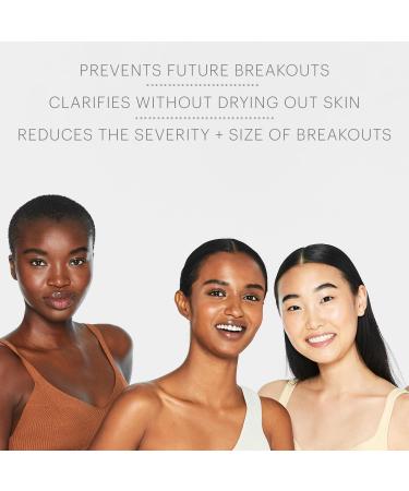 Glo Skin Beauty Acne Spot Treatment 5% Sulfur - Effective Breakout Relief for Acne-Prone & Oily Skin - Buy Online on GoSupps.com