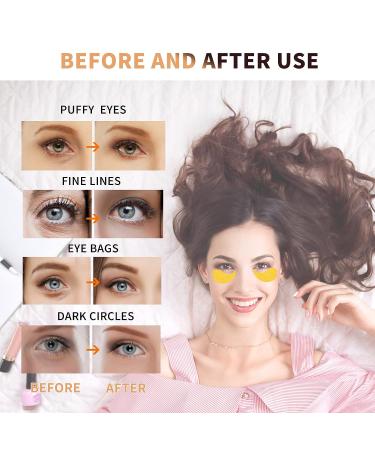 24K Gold Eye Masks - 70PCS for Dark Circles, Puffiness & Eye Bags Treatment - Buy Online on GoSupps.com