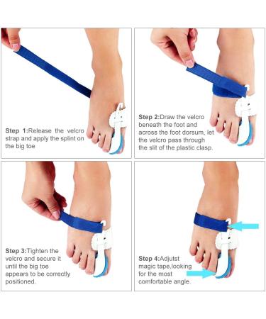 Bunion Corrector Kit - 7Pcs Adjustable Splint, Soft Gel Night Time Relief for Big Toe Pain, Bunion Pads, Toe Straightener & Separators - Buy Online on GoSupps.com