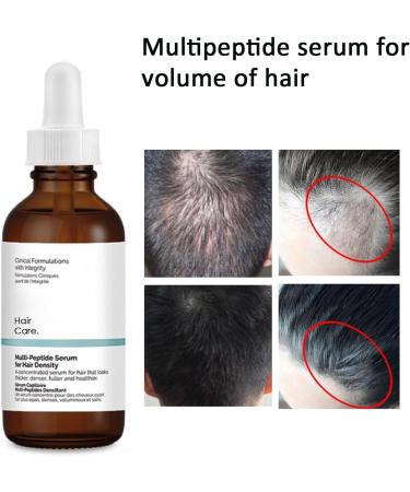 Multi-Peptide Serum for Hair growth Hair Growth Essential Oil Multi-Peptide Essential for Hair - Buy Online on GoSupps.com