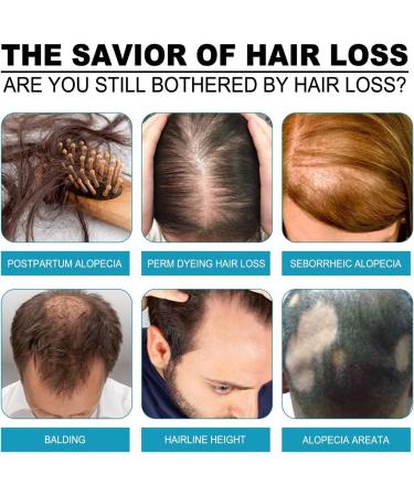 30ml Hair Growth for Women | Hair Thickening Spray for Thin Hair - Keeps Hair Regrowth for Men and Women Hair for Men Women Thinning Repair Care - Buy Online on GoSupps.com