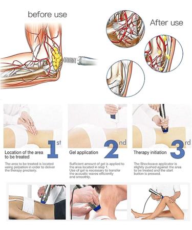 Shock Wave Therapy Device for ED & Pain Relief | Extracorporeal Shock Wave Massager for Muscle Pain Relief - Buy Online on GoSupps.com