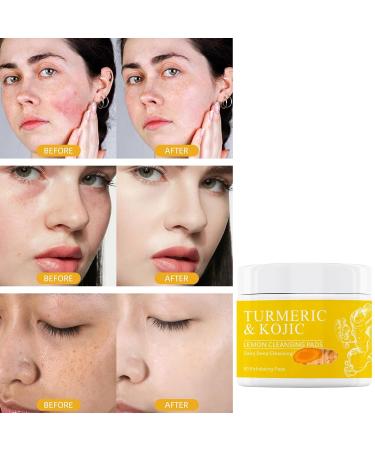 Buy Turmeric Cleansing Pads | Exfoliating Face Wash with Kojic Acid | Dark Spot Remover | International Shipping - Buy Online on GoSupps.com