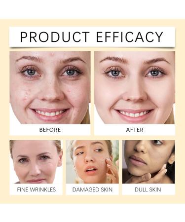 TS TAC-SKY Moisturizing Facial Serum - Gentle Nourishment Hydrates Dry Skin Boosts Glow Easy-to-Use Skincare(1PCS) - Buy Online on GoSupps.com