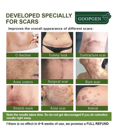 Goopgen Advanced Scar Repair Serum - Medical Grade Scar Removal for All Types of Scars (2PCS) - Buy Online on GoSupps.com