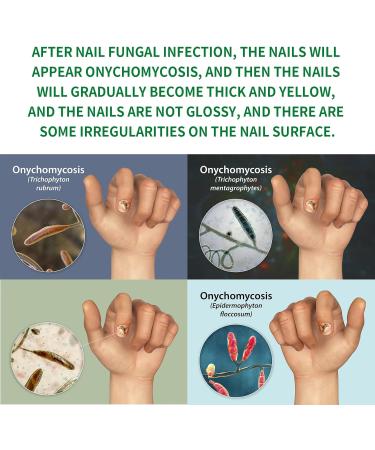 Soin Ongles Avanc au Gingembre - R pare les ongles ab m s pr vient la propagation et redonne de l' clat aux mains et aux pieds flacon de 30 ml - Buy Online on GoSupps.com