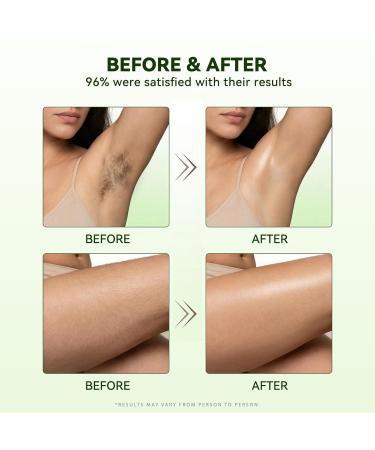 Cyperus Rotundus Oil - Natural Hair Growth Inhibitor for Women & Men - Smooth Skin Body Oil After Waxing or Shaving - Safe for Face Leg Underarm & Sensitive Skin - 60ml(2 fl oz) clear - Buy Online on GoSupps.com