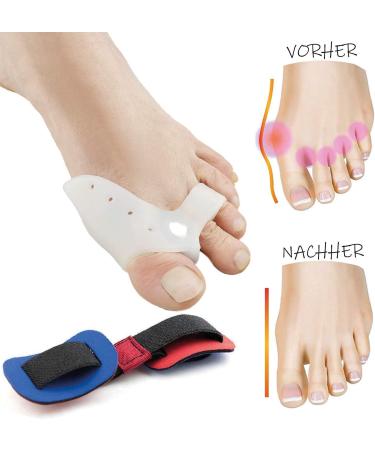 ValgoFit Toe Separator 6x - Hallux Valgus Relief with Ball Protection | Chemical-Free + Training Band & eBook - Buy Online on GoSupps.com