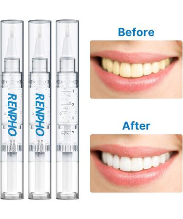 RENPHO Teeth Whitening Pens 3 Pack - Professional 35% Carbamide Peroxide Gel for Sensitive Teeth - No Sensitivity, Painless, Easy to Use - 20+ Uses - Buy Online on GoSupps.com