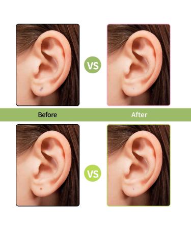 Simarro 180Pcs Disposable Earrings Hole Cleaner - Ear Care Kit for Piercing Aftercare Odor Removal | Green Rose Red Yellow - Buy Online on GoSupps.com