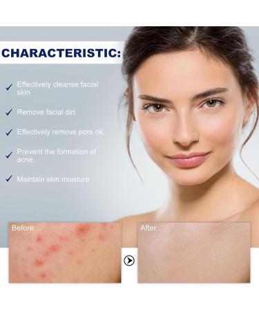 Mousse nettoyante pour l'acn Lotion Nettoyante Visage Et Corps Acne Clean Foam Cleanser Mousse nettoyante Nettoyant pour le Visage Doux pour le Nettoyage des Pores Profonds - Buy Online on GoSupps.com